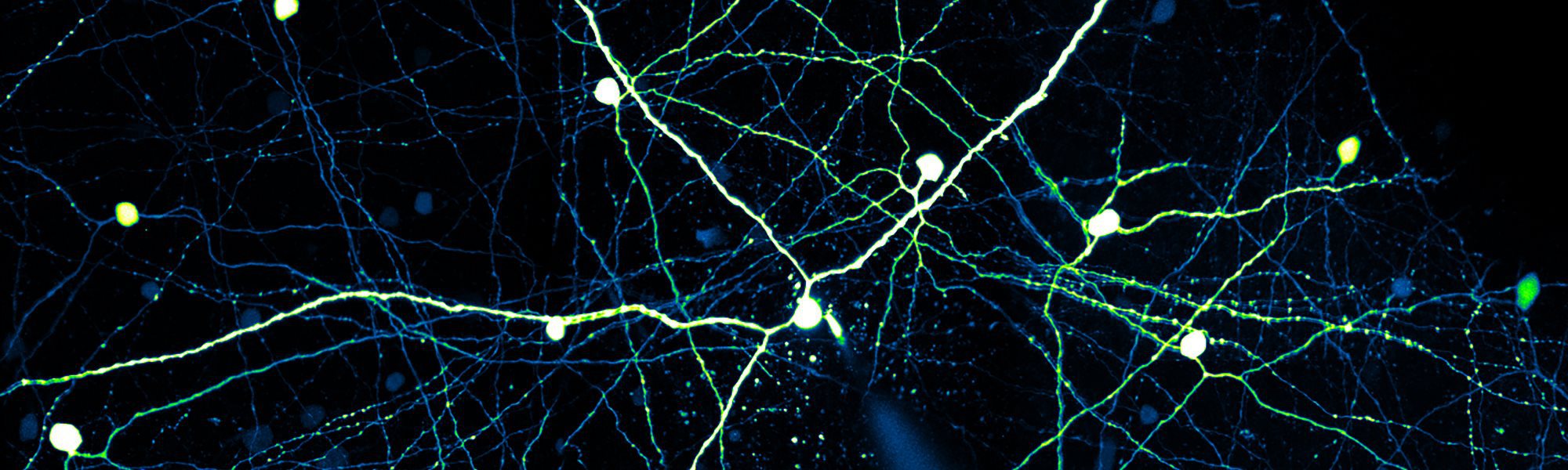 Using a Scientifica Multiphoton Microscope for investigating retinal ...